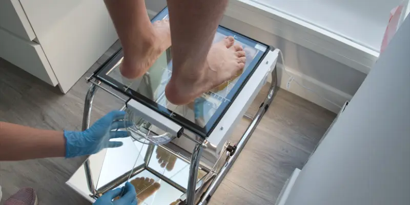foot x-ray