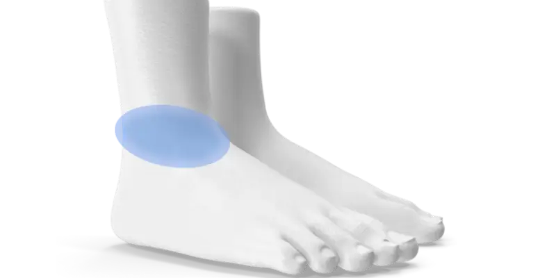 Sprunggelenkprothese