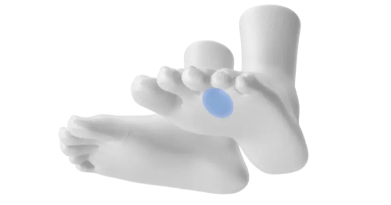 Physiotherapie bei Morton-Neurom